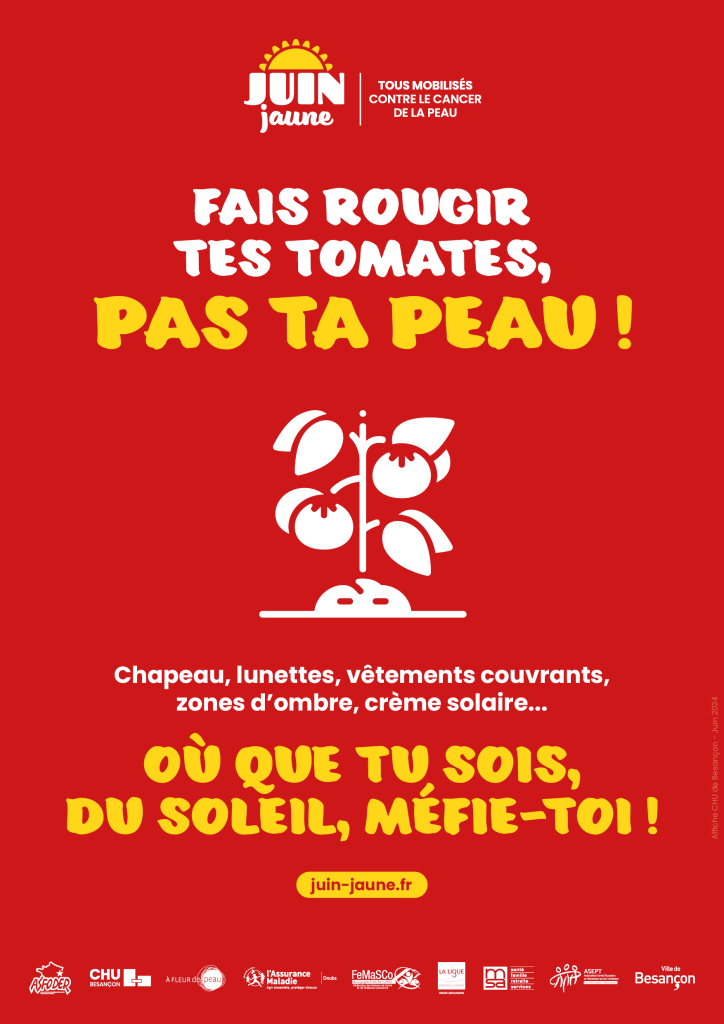 Fais rougir tes tomates, pas ta peau !